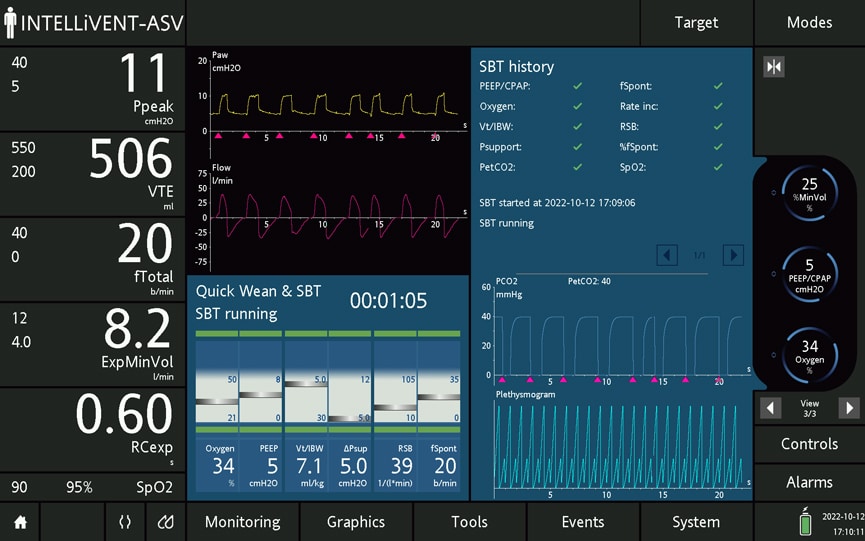 INTELLiVENT-ASV - The top 3 benefits of individualized ventilation