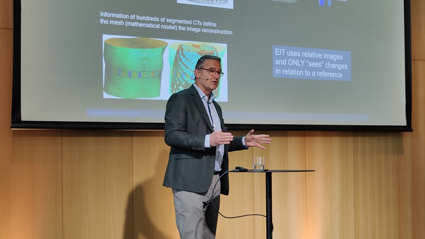 EIT – a new tool for individualized ventilation.